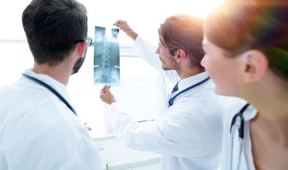 Diagnose einer zervikalen Osteochondrose